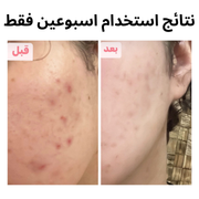 فلتر العناية بالبشرة من فلتري